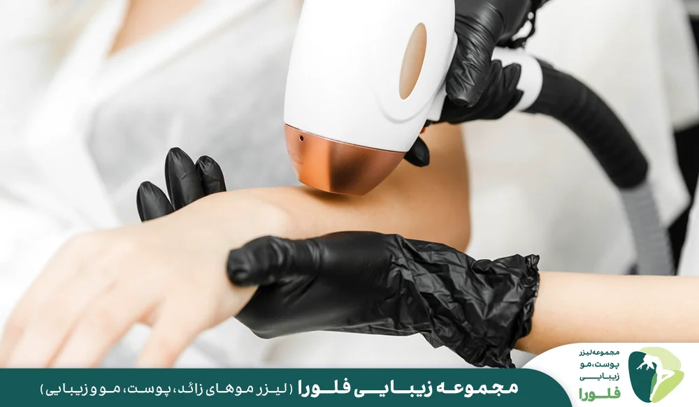 نکات مهم قبل از لیزر موهای زائد دست
